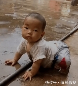 医院|“手上长了两根硬刺,去医院看什么科?”哈哈