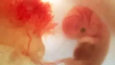 宝宝|一组图记录怀胎十月,胎儿发育全过程,看完后,感叹生命神奇