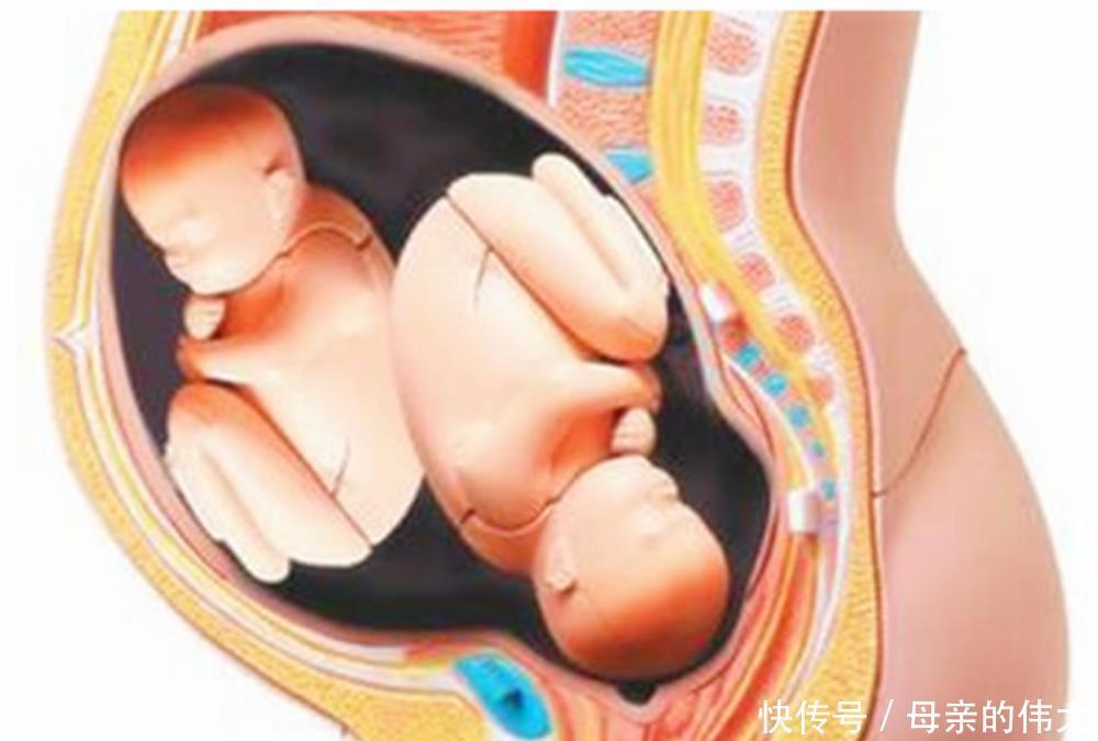 宝宝|怀孕后多久,胎位就要固定了?这个孕周前,孕妈还能“调乾坤”