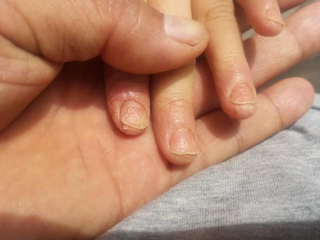 小米粥|这些“糊弄式”早餐,正一点点地吞噬娃的健康,可很多宝妈还在做