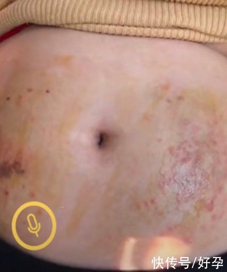 宝宝|“为生孩子，打了五百多支保胎针，值得吗？”宝妈的回答让人流泪