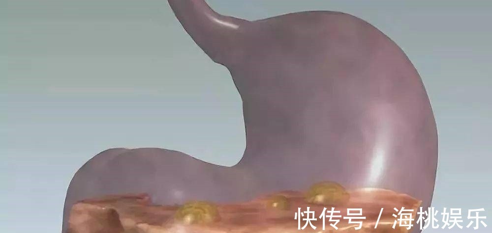 胃部|胃功能不好的人,3物紧着吃,若坚持,胃不疼,胃病绕着走