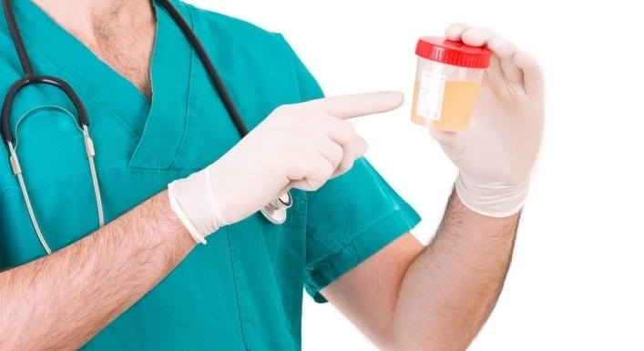 高嘌呤食物|4种食物是升高尿酸的“罪魁祸首”,若你也爱吃,尽早忌口!