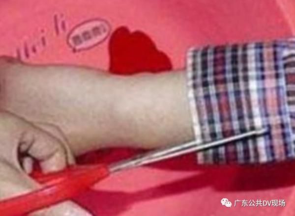 医生|女童掉进洗澡水被大面积烫伤,医生:牢记这5个字可救命