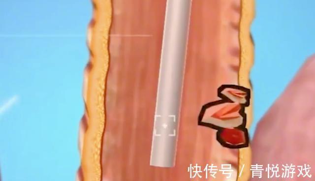 医生|故事吉林1岁男童体内埋藏定时炸弹,致命肿瘤横行,医生妙手回春