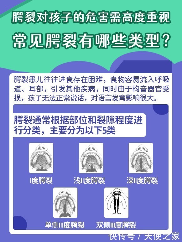 张磊涛|《天使科普》关爱兔唇宝宝 张磊涛教授带你了解唇腭裂
