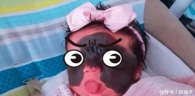 胎记|当年做8次整容手术,让人印象深刻的“蝙蝠侠女孩”,后来怎么样