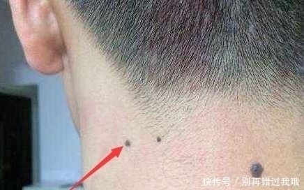 面相|女人脸上的三颗痣,相夫教子,最后一种最有福