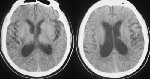 不想孩子被毁，请拒绝“奶奶式教育”，这些忠告请牢记