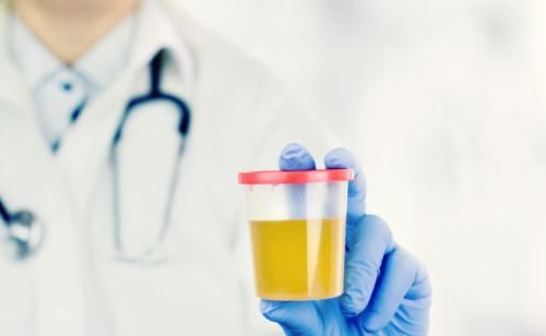 水肿|肾功能出现下降也是有“信号”的，快看看你有没有！