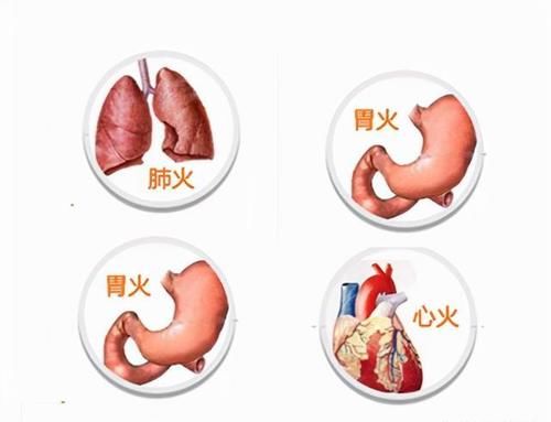 阴虚火旺|容易上火是什么原因,是阴虚火旺体质吗?怎么调理比较好?