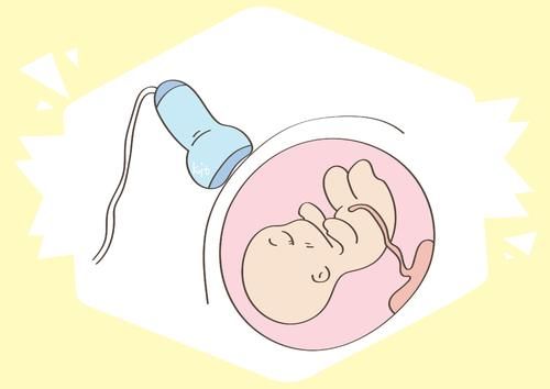 胎儿|进入孕晚期，这几个方面孕妈要注意，对己对娃有利无害