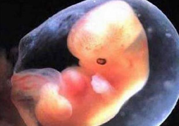 孕期|准妈妈记住“4不碰”,可以保持羊水“清澈”,让宝宝住得更舒心