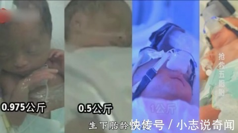 夫妻两人|1.6米孕妇生下五胞胎,最小的孩子只有鸡蛋那么点大,孩子命悬一线