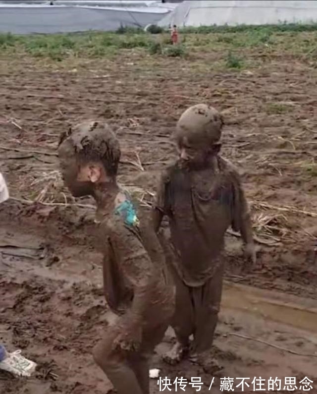 潍坊|潍坊两男童,眨眼间“面目全非”!孩子妈妈:不敢相信是自己生的