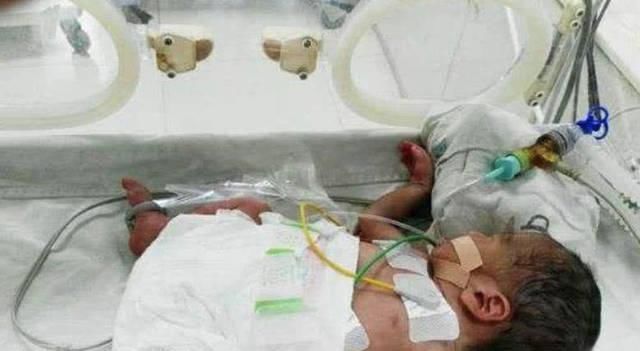 这种血型的妈妈建议只生一个,否则二胎可能引起“新生儿溶血症”