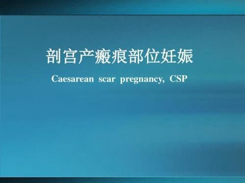 胎儿|“顺产再好,我也不选”,95后孕妈给出的理由,让人很难反驳