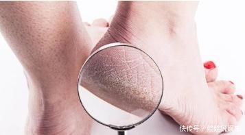 肝脏|肝脏的“救命良药”找到了， 早晚2杯，修复肝细胞，肝病不来！