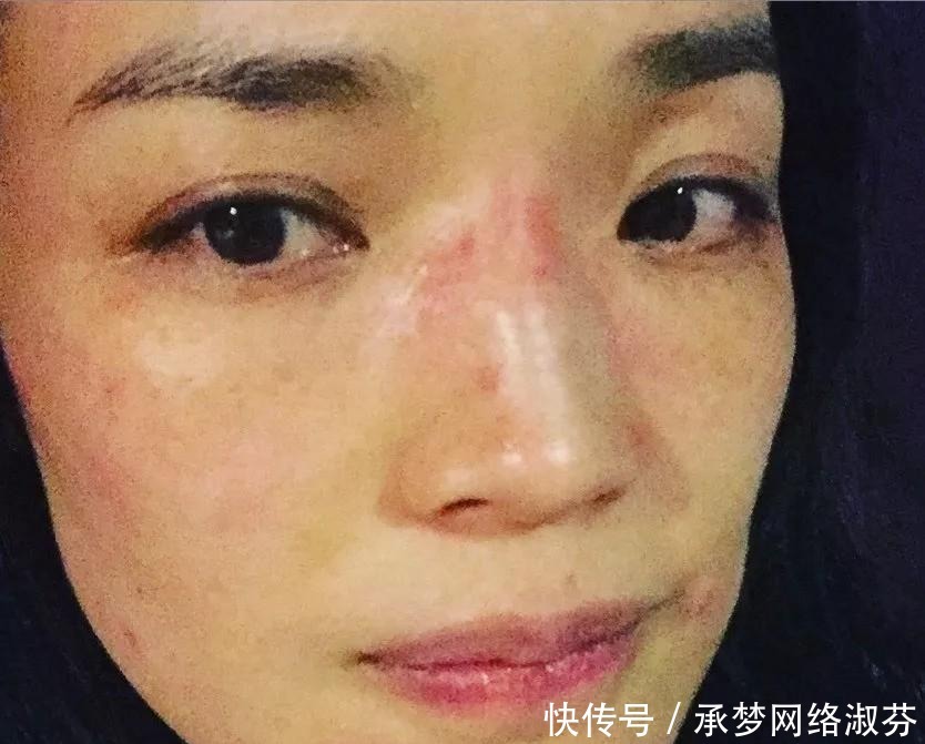 激素脸|为什么很多女生不护肤反而皮肤更好？坚持做这3件事，皮肤都不差