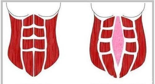 母爱|生完三胞胎后肚子却收不回去,国外宝妈的晒照,诠释伟大母爱