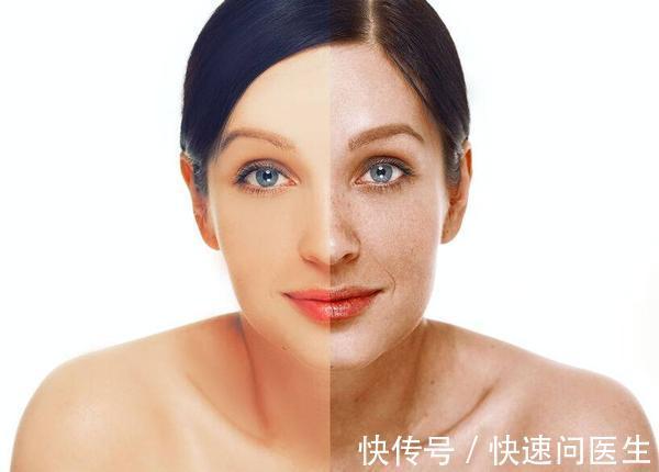 潮热|女性若有这5种表现，可能是“更年期”快到了，别不当回事