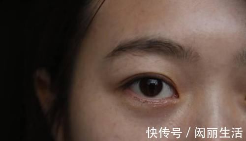 先知|血糖超标头先知头部出现哪些信号,暗示血糖可能已经失控了