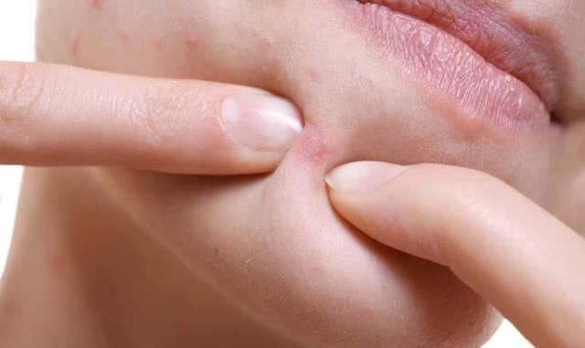 妇科炎症|妇科病都“写”在脸上脸上若没4个“异常”,恭喜子宫还很健康