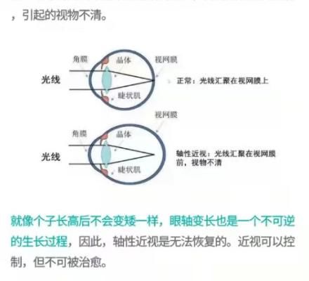 寒假期间帮助孩子预防近视，家长不妨这样做