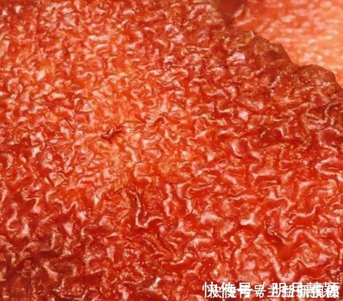 好吃|难怪饭店里的扣肉那么好吃，原来诀窍在这里，软糯喷香，肥而不腻