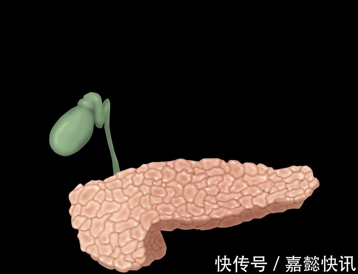 胆汁淤积|胰腺癌发出的三个信号,经常是这些症状,可是你却一拖再拖