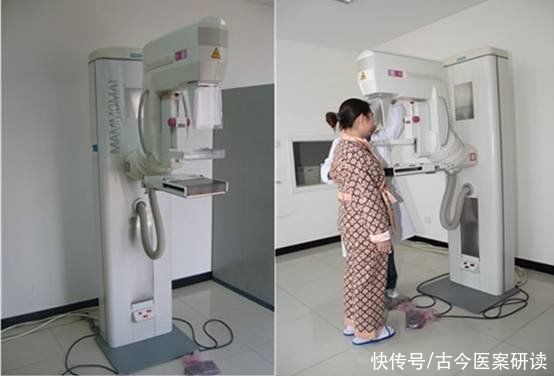 胸部|查出乳腺结节，别慌，避免4个习惯，做好3件事，乳腺慢慢变健康