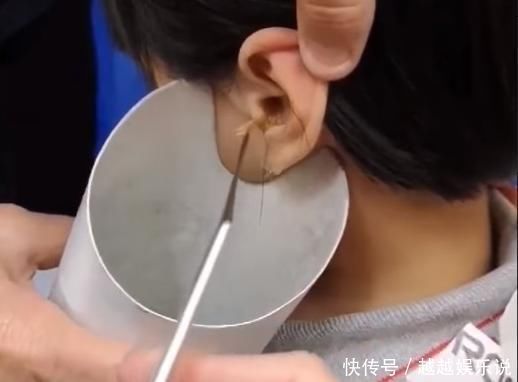 棉花棒|粗心妈妈以为孩子反应迟钝原来是耳垢填满耳朵,导致孩子听不到