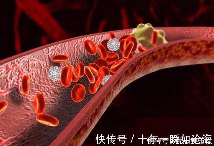 导管|血管支架能穿进人的血管，为何不直接用支架把血管里的血栓吸出