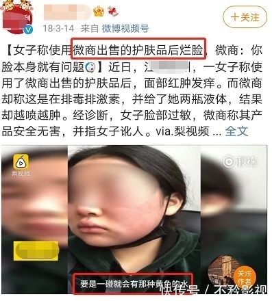 质地|怀孕不能用护肤品，会致畸？网友：怪不得这么早就被叫“阿姨”