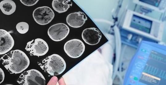 手足|时常手脚发麻?可能是身体在向你求救!要严防6种疾病侵袭!