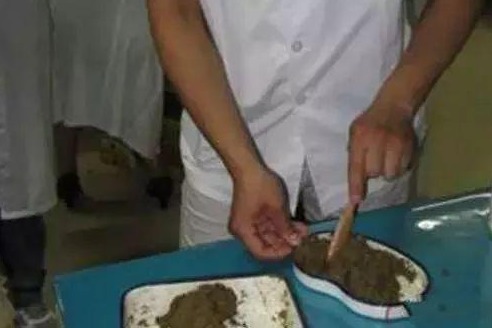 疗程|膝盖骨痛有救了,家有腰腿疼痛的人,记得存起来,受益颇深!