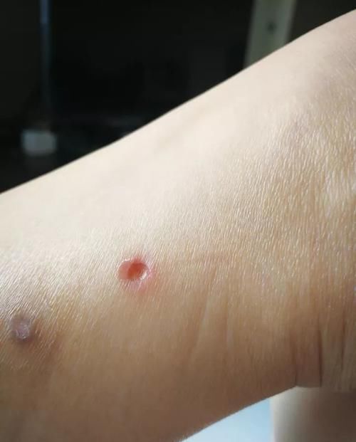  会出|有一种花叫?“灸花”，你可千万别小看它！来听听老中医怎么说？
