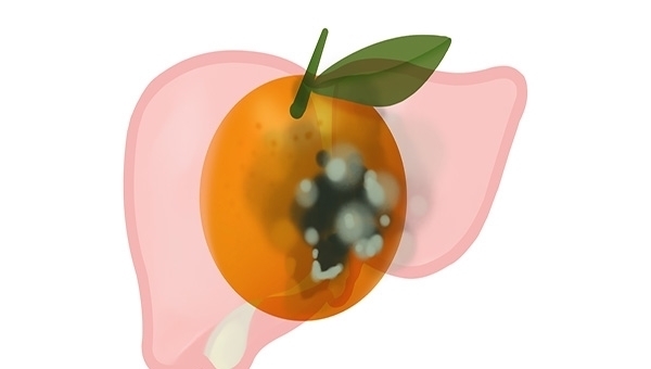 被世卫组织列为第一类致癌物,与烟草同级别,你知道哪些?