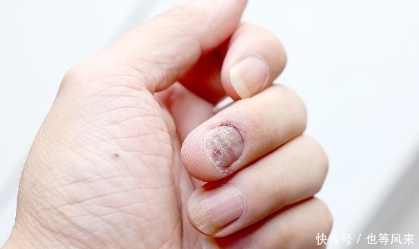 肝脏还|肝好的人,手上可能有3个暗号,哪怕你占一个,肝也比较健康