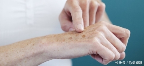 六十不到老年斑就开始“泛滥”,改掉三个坏习惯,皮肤越来越干净