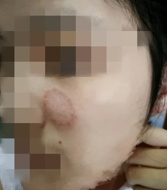 人家|7岁男孩头发一簇簇往下掉!罪魁祸首很多人家里都有!