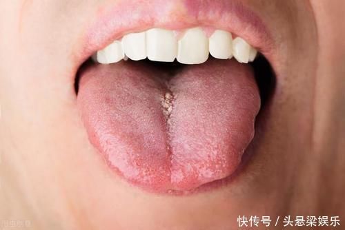 水液|湿气家族“痰、饮、水、湿”，别傻傻分不清楚，收藏一下吧