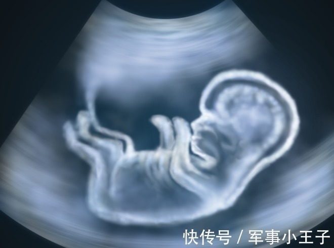 胎儿|孕期肚子里的胎儿健不健康?只要看这2个指标就够了!
