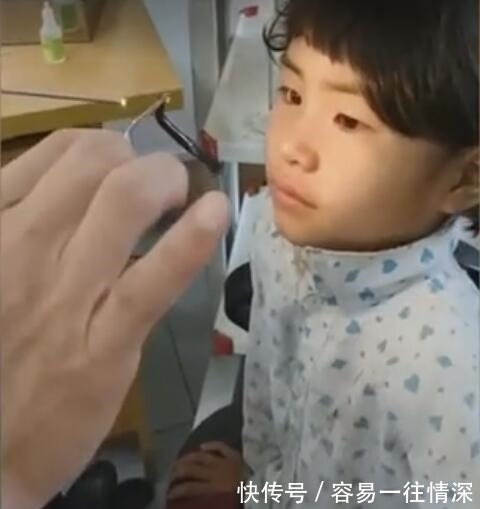 活虫子|奇闻:医生从小女孩鼻子里取出一条活虫子,女孩看见后一脸淡定