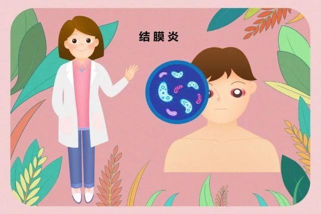 病毒性结膜炎|眼睛痒、有红血丝，快来看看是不是结膜炎！医生教你怎么处理