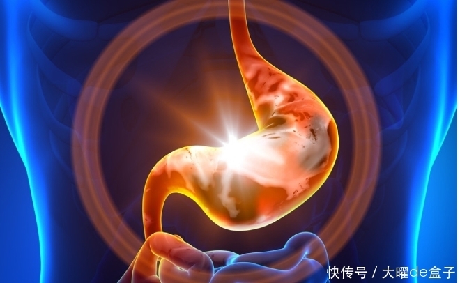 修复|修复胃粘膜的4个“好帮手”,不妨坚持吃,让你的胃一天好过一天