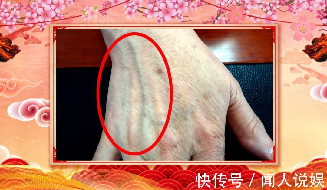 青筋|身体好不好，看手就知道！这几处变化可能藏大病
