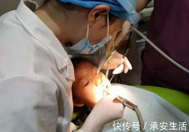 牙齿|3岁的孩子满口“小黑牙”?罪魁祸首不是糖,而是父母无知惹的祸