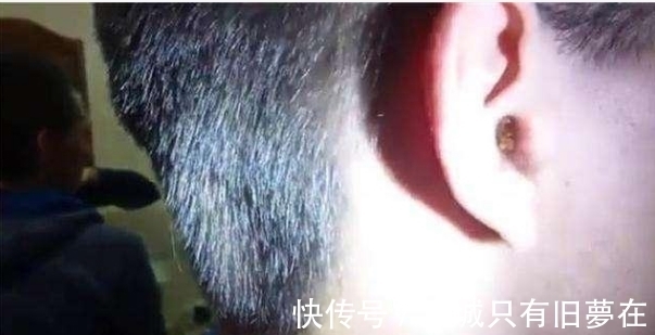 检查|男孩耳朵有异物,去医院检查后,医生一句话让母亲羞愧难堪