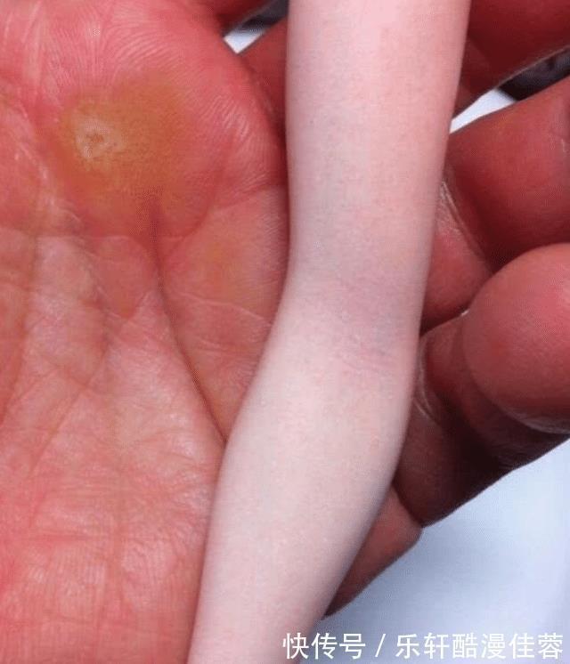 动漫|手办能有多逼真能看到血丝还不算,这手办连脚汗效果都能做出